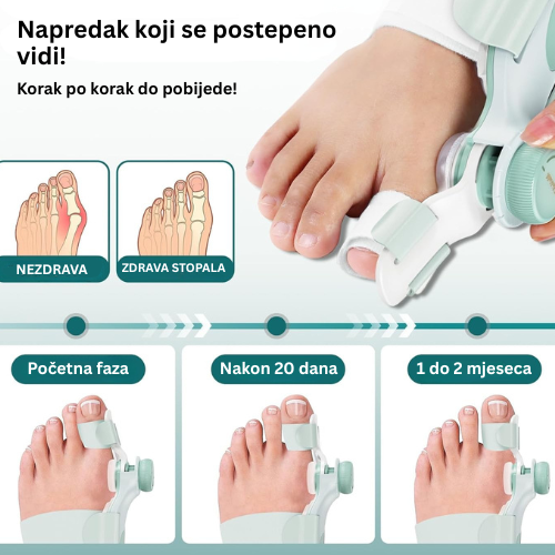 Ortopedsko Pomagalo Za Stopala