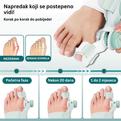 Ortopedsko Pomagalo Za Stopala