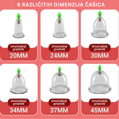Elektricni aparat za hidzamu